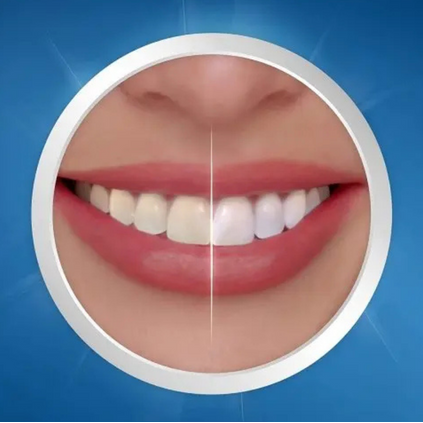 Crest 3D White Expert Whitening