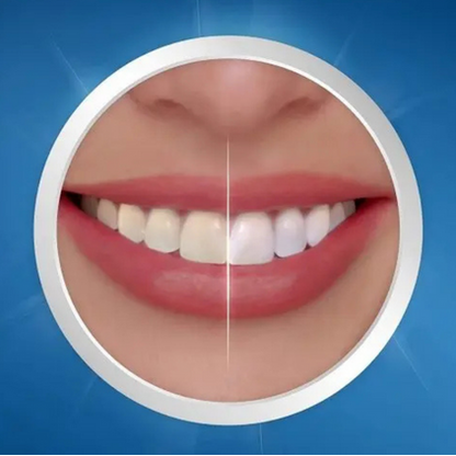 Crest 3D White Expert Whitening