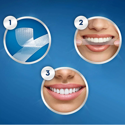 Traitement Crest 3D White – Glammourous Effects.