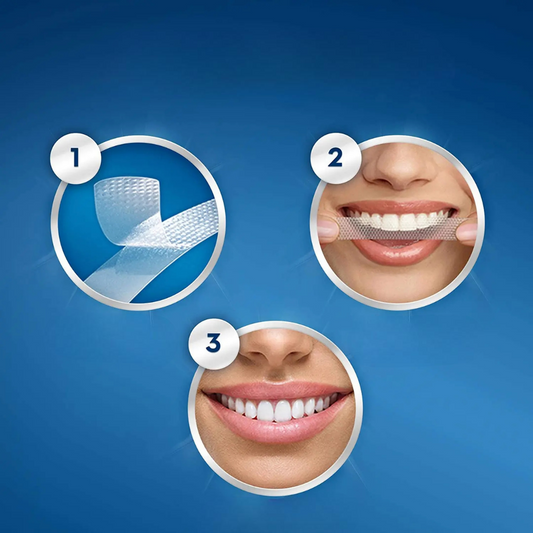 Traitement Crest 3D White – Luxe Professional Effects.