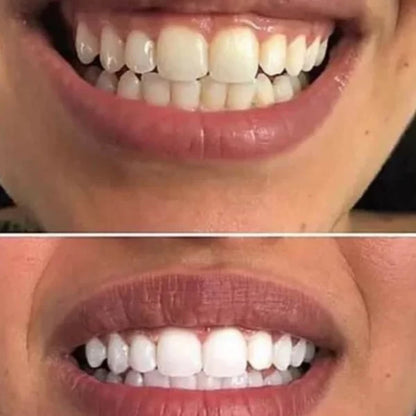 Traitement Crest 3D White – Glammourous Effects.